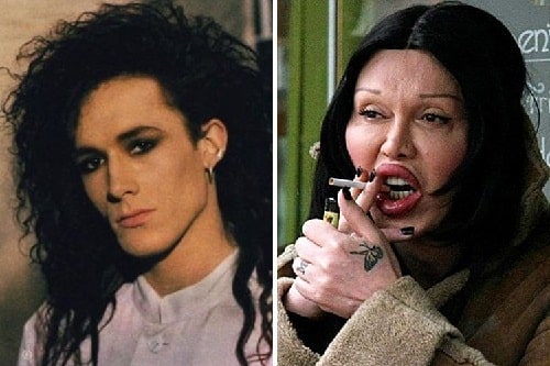 A picture of Pete Burns before (left) and after (right).